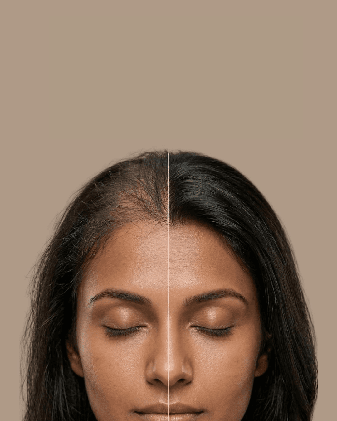 Why Your Hair Becomes Thinner After 40